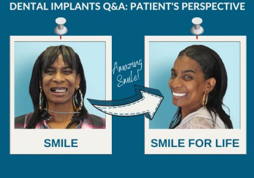 A Patient’s Perspective Dental Implants Q&A
